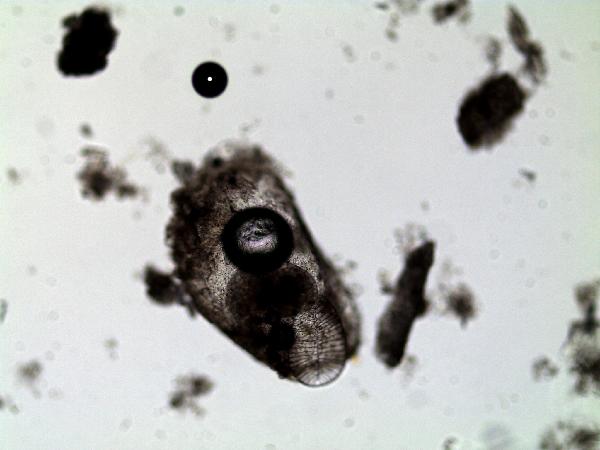ostracode_with_diatom_JS-600.jpg