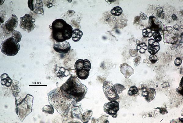 Foraminifera_1ppl1-600.jpg