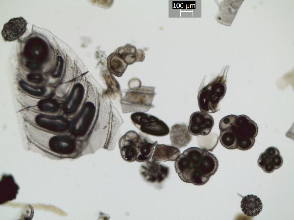 Foraminifera_2_GR-600.jpg