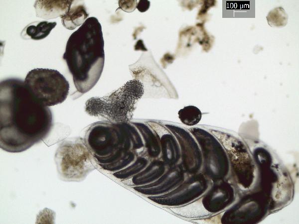 Foraminifera_3_GR-600.jpg