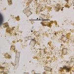 Iron (Hydr)oxides, Non-opaque (Hematite/Limonite)