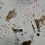 Plagioclase